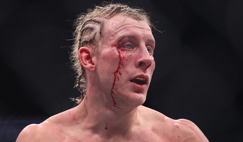 paddy pimblett nosokomeio