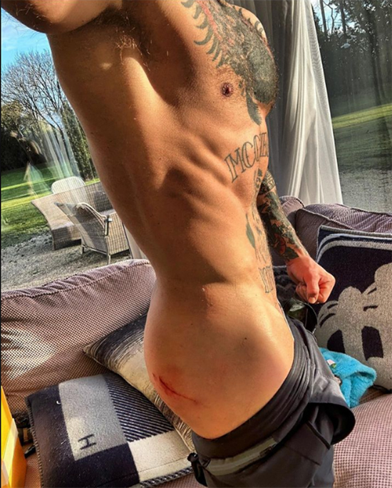 conor mcgregor pesimo