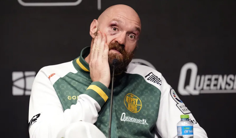 tyson fury 3002