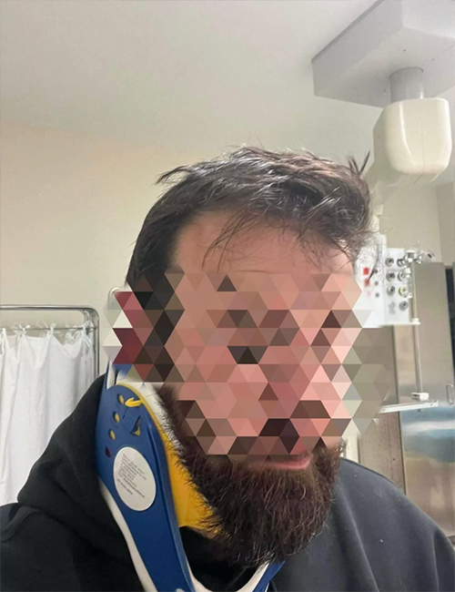 pygmaxos xylodarmos patras