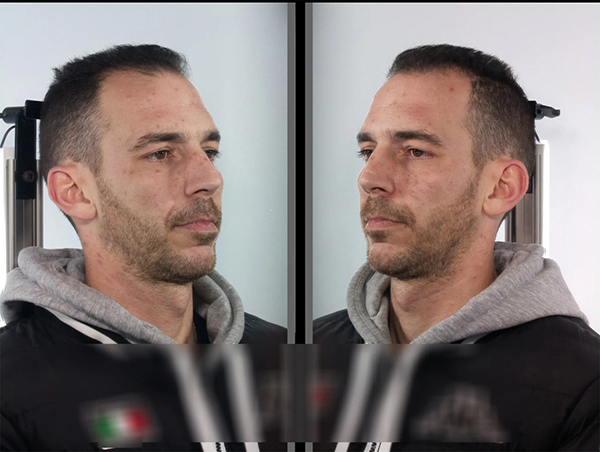 proponitis aselgeia 149