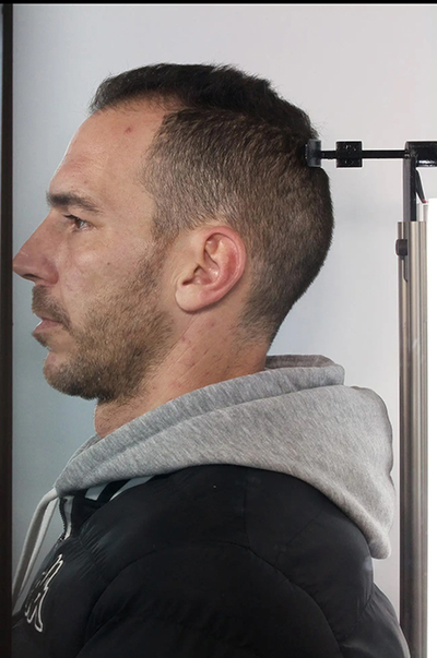 proponitis aselgeia 14909