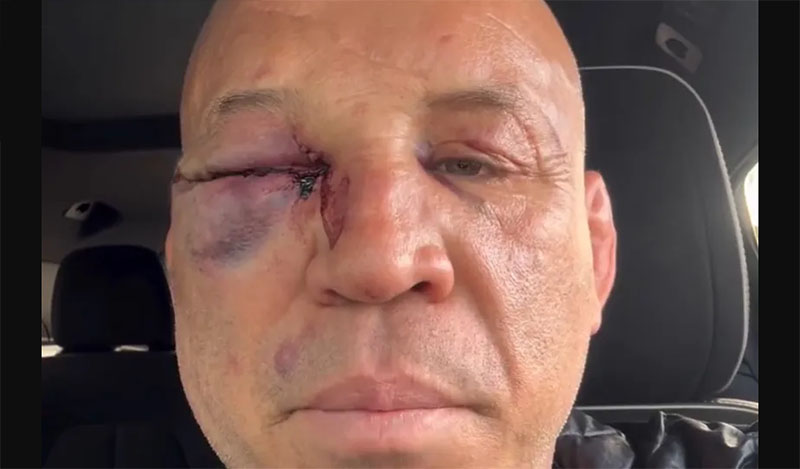 wanderlei silva prosopo